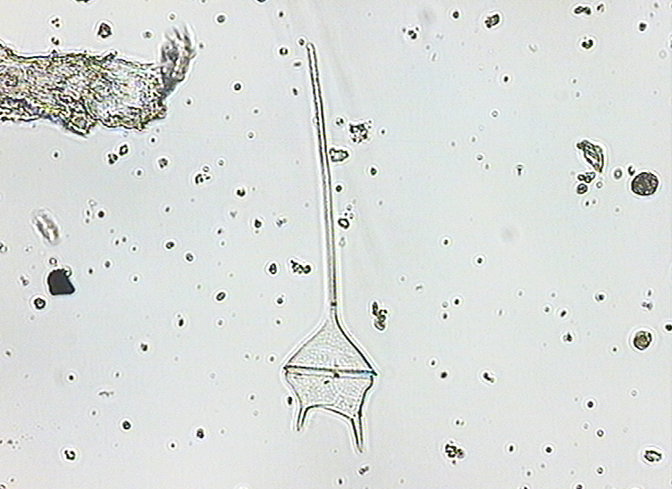 Dictyocha speculum